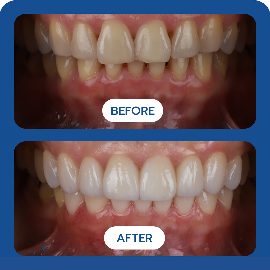 Before and After Case 1